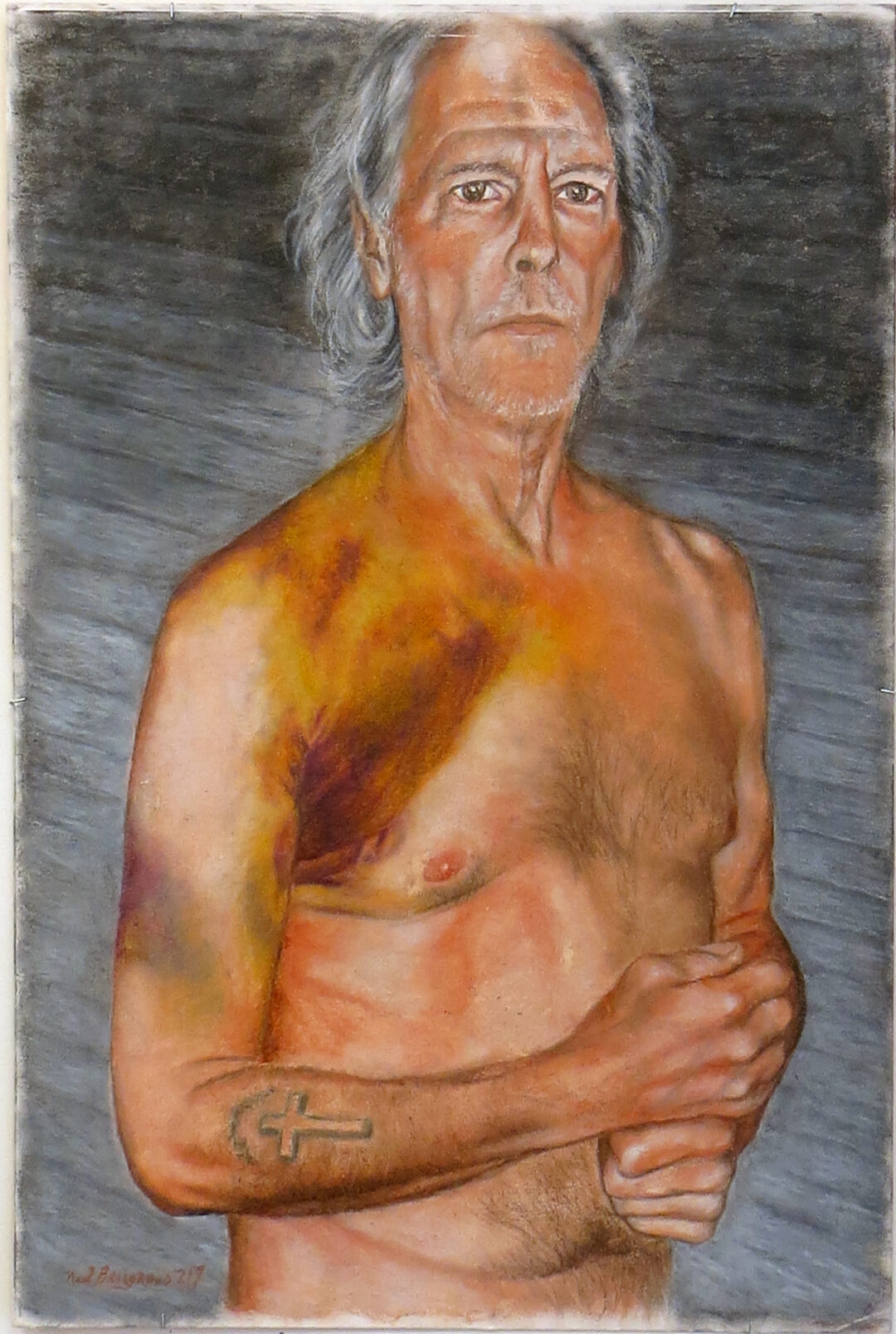 Neil Besignano “Self portrait with broken shoulder” oil pastel on illustration board, 20”W x 30” H –  $250.00